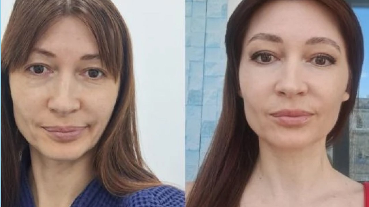 Пластический Хирург | Хлысталов Максим