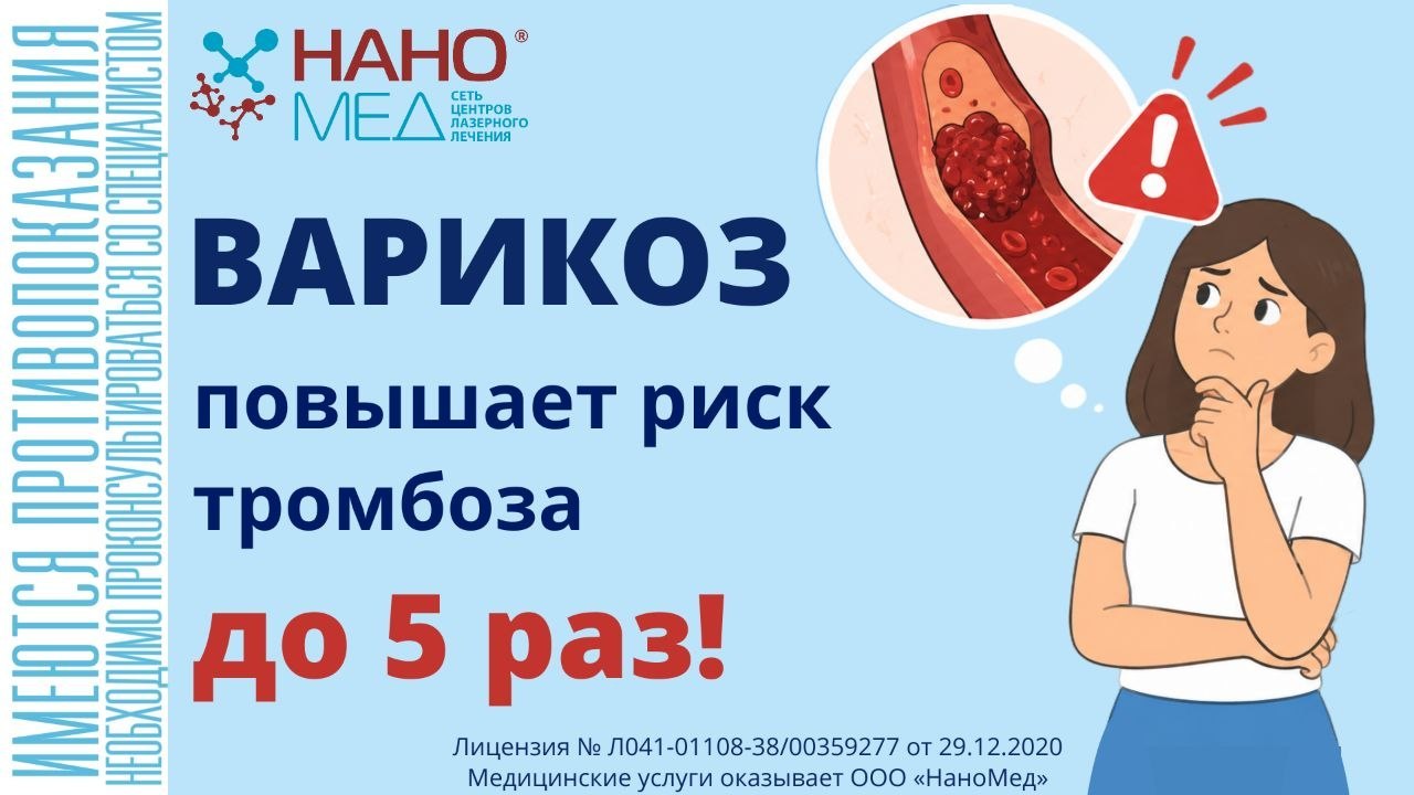 Без Бахил